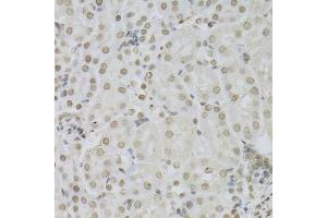 Immunohistochemistry of paraffin-embedded mouse kidney using MAPK3 Antibody.