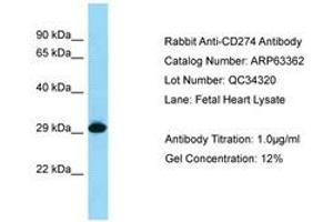 Image no. 1 for anti-CD274 (PD-L1) (C-Term) antibody (ABIN6749975) (PD-L1 anticorps  (C-Term))