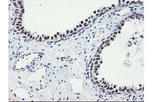 Image no. 6 for anti-SUMO1/sentrin/SMT3 Specific Peptidase 2 (SENP2) (AA 139-523) antibody (ABIN1490925)