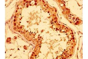 IHC image of ABIN7142343 diluted at 1:400 and staining in paraffin-embedded human testis tissue performed on a Leica BondTM system.