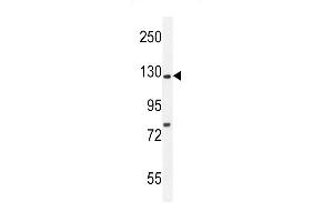 Kif5C-2 Antibody (ABIN655993 and ABIN2845375) western blot analysis in mouse brain tissue lysates (35 μg/lane).