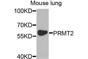 Western blot analysis of extracts of mouse lung, using PRMT2 antibody. (PRMT2 anticorps)