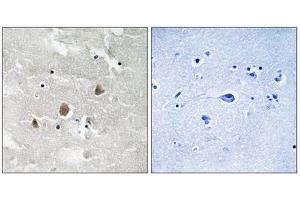 Immunohistochemistry analysis of paraffin-embedded human brain tissue using MAP3K1 (Phospho-Thr1402) antibody.
