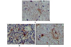 Immunohistochemical analysis of paraffin-embedded human brain tissue (A), lymphoid follicles tissue (B) and interbrain tissue (C), showing cytoplasmic localization using S100A antibody with DAB staining. (S100A1 anticorps)