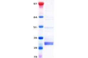 Validation with Western Blot