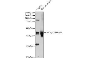 Western blot analysis of extracts of various cell lines, using SERPINF1 antibody (ABIN3022372, ABIN3022373, ABIN3022374, ABIN1513515 and ABIN6218766) at 1:1000 dilution. (PEDF anticorps  (AA 1-200))