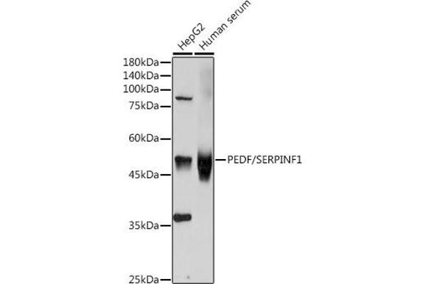PEDF anticorps  (AA 1-200)