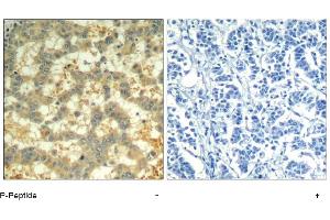 Image no. 1 for anti-Spleen tyrosine Kinase (SYK) (pTyr323) antibody (ABIN319292) (SYK anticorps  (pTyr323))