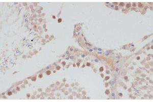 Immunohistochemistry of paraffin-embedded Rat testis using CCNG1 Polyclonal Antibody at dilution of 1:100 (40x lens). (Cyclin G1 anticorps)