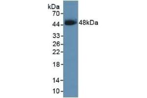 Detection of Recombinant SCCA1, Human using Polyclonal Antibody to Serpin B3 (SERPINB3)