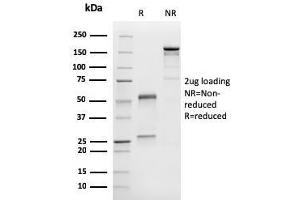 SDS-PAGE Analysis Purified Melan-A Monoclonal Antibody (M2-9E3).