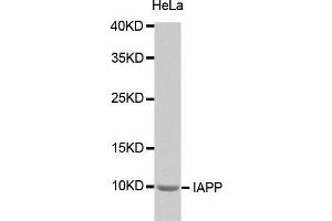 Western Blotting (WB) image for anti-Islet Amyloid Polypeptide (IAPP) antibody (ABIN1873117) (Amylin/DAP anticorps)