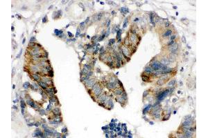 anti-High Mobility Group Box 2 (HMGB2) (AA 65-97), (N-Term) antibody