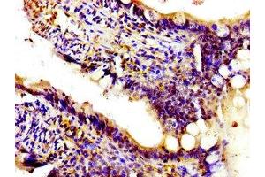 Immunohistochemistry of paraffin-embedded human small intestine tissue using ABIN7163188 at dilution of 1:100