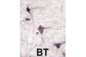 Formalin-fixed and paraffin-embedded human brain tissue reacted with PTPRR polyclonal antibody  , which was peroxidase-conjugated to the secondary antibody, followed by DAB staining. (PTPRR anticorps  (N-Term))