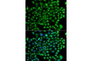 Immunofluorescence analysis of A549 cell using ZFYVE1 antibody. (ZFYVE1 anticorps)