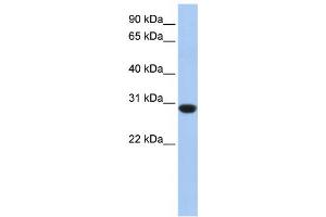 Western Blotting (WB) image for anti-Ankyrin Repeat and SOCS Box-Containing 12 (ASB12) antibody (ABIN2459538)
