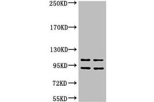 Western blot analysis of 1) Hela, 2) HepG2, diluted at 1:2000 (IDE anticorps)