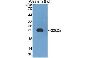 Western blot analysis of the recombinant protein. (UMPS anticorps  (AA 311-481))