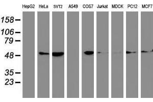 Image no. 5 for anti-Tubulin beta 4a (TUBB4A) antibody (ABIN1501579)