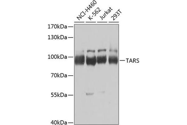TARS anticorps  (AA 1-230)