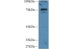 Western Blot; Sample: Human Hela cell lysate; Primary Ab: 1µg/ml Rabbit Anti-Human IkBz Antibody Second Ab: 0. (Inhibitory Subunit of NF-KappaB zeta (AA 422-651) anticorps)