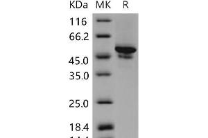 Western Blotting (WB) image for Carbonic Anhydrase IX (CA9) (Active) protein (His tag) (ABIN7194573)