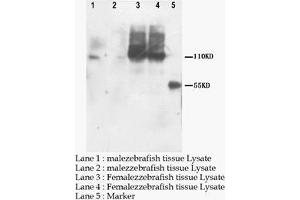 Western blot: PNPLA6 Polyclonal Antibody (PNPLA6 anticorps  (C-Term))