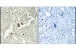 Immunohistochemistry analysis of paraffin-embedded human brain tissue, using NSG2 Antibody. (NSG2 anticorps  (AA 33-82))