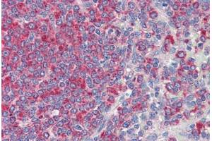 Human Spleen (formalin-fixed, paraffin-embedded) stained with CD34 antibody ABIN337152 at 10 ug/ml followed by biotinylated secondary antibody, alkaline phosphatase-streptavidin and chromogen.