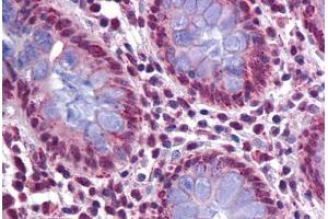 Human Colon: Formalin-Fixed, Paraffin-Embedded (FFPE)