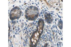 ABIN6266773 at 1/100 staining human colon tissue sections by IHC-P. (TNFSF13 anticorps  (Internal Region))