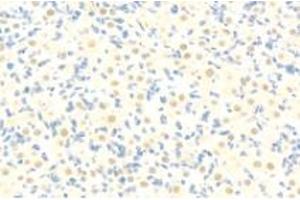 Immunohistochemistry analysis of paraffin-embedded rat ovary using mSin3A (ABIN7075609) at dilution of 1: 100