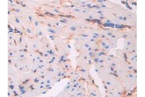 Detection of CD34 in Mouse Heart Tissue using Polyclonal Antibody to Cluster Of Differentiation 34 (CD34)