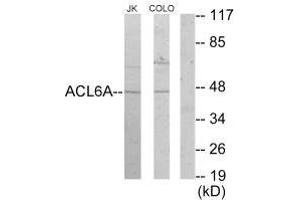 Western blot analysis of extracts from Jurkat cells and COLO205 cells, using ACL6A antibody. (BAF53A anticorps)
