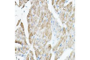 Immunohistochemistry of paraffin-embedded rat heart using VEGFB Rabbit pAb (ABIN7271298) at dilution of 1:150 (40x lens).