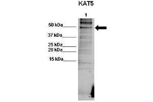WB Suggested Anti-KAT5 Antibody  Positive Control: Lane 1: 50ug human RKO lysate  Primary Antibody Dilution :  1:500  Secondary Antibody : Goat anti-rabbit-Alexa Fluor 680  Secondry Antibody Dilution :  1:5000  Submitted by: Dr. (KAT5 anticorps  (C-Term))