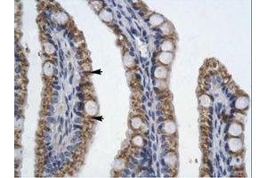 Image no. 1 for anti-Paired-Like Homeodomain 2 (PITX2) (AA 20-69) antibody (ABIN202245)