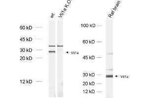 dilution: 1 : 1000, sample: brain homogenate from wildtype and Vti1a K. (VTI1A anticorps)