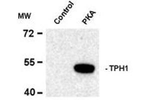 Image no. 2 for anti-Tryptophan Hydroxylase 1 (TPH1) (pSer58) antibody (ABIN227714) (Tryptophan Hydroxylase 1 anticorps  (pSer58))