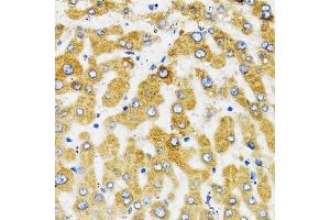 Immunohistochemistry of paraffin-embedded human liver using SLC27 antibody (ABIN3021377, ABIN3021378, ABIN1513532 and ABIN6214970) at dilution of 1:100 (40x lens).