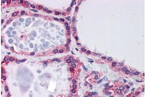 Human Thyroid: Formalin-Fixed, Paraffin-Embedded (FFPE)