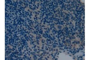 Detection of NPPB in Mouse Spleen Tissue using Polyclonal Antibody to Natriuretic Peptide Precursor B (NPPB)