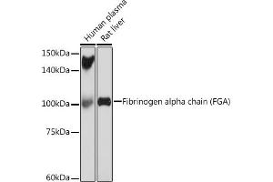 Western blot analysis of extracts of various cell lines, using Fibrinogen alpha chain (FGA) (FGA) Rabbit mAb (ABIN7267177) at 1:1000 dilution. (FGA anticorps)