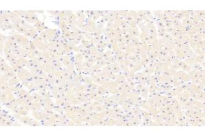 Detection of MYH1 in Human Cardiac Muscle Tissue using Polyclonal Antibody to Myosin Heavy Chain 1 (MYH1)