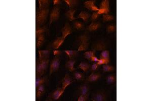 Immunofluorescence analysis of C6 cells using BRC antibody (1034) at dilution of 1:100. (BRCA1 anticorps  (AA 400-699))