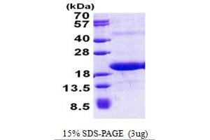 SDS-PAGE (SDS) image for Mediator Complex Subunit 21 (MED21) (AA 1-144) protein (His tag) (ABIN7280274) (MED21 Protein (AA 1-144) (His tag))