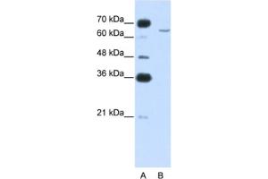 Western Blotting (WB) image for anti-Cytoplasmic Polyadenylation Element Binding Protein 2 (CPEB2) antibody (ABIN2462355) (CPEB2 anticorps)