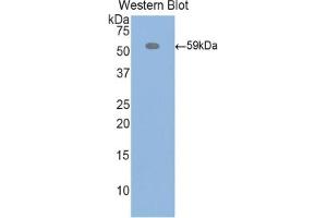 Detection of Recombinant ITIH4, Rat using Polyclonal Antibody to Inter Alpha-Globulin Inhibitor H4 (ITIH4)