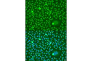 Immunofluorescence analysis of U2OS cells using CDK10 antibody.